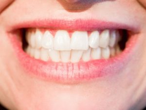 dental